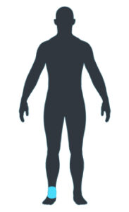physio symptom checker