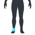 Online Physio Rehab