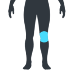 Online Physio Rehab